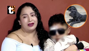 Niño queda desfigurado tras salvaje ataque de perros y podría perder la vista: “Quiero que los cirujanos me ayuden”