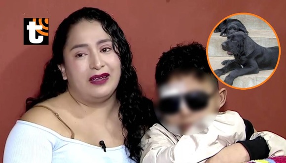 Niño es atacado por perros y queda desfigurado
