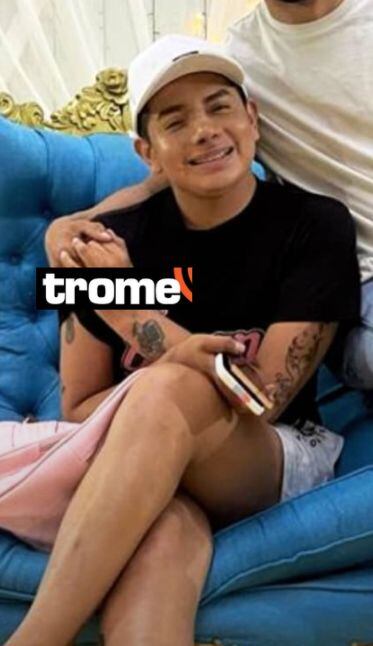 Bryan Arámbulo se hizo retoquito en la nariz y ahora luce nuevo perfil