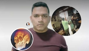 ¡Indignación en Piura! Le desfigura el rostro a otro hombre por salir con su expareja y queda libre por cambio de ley