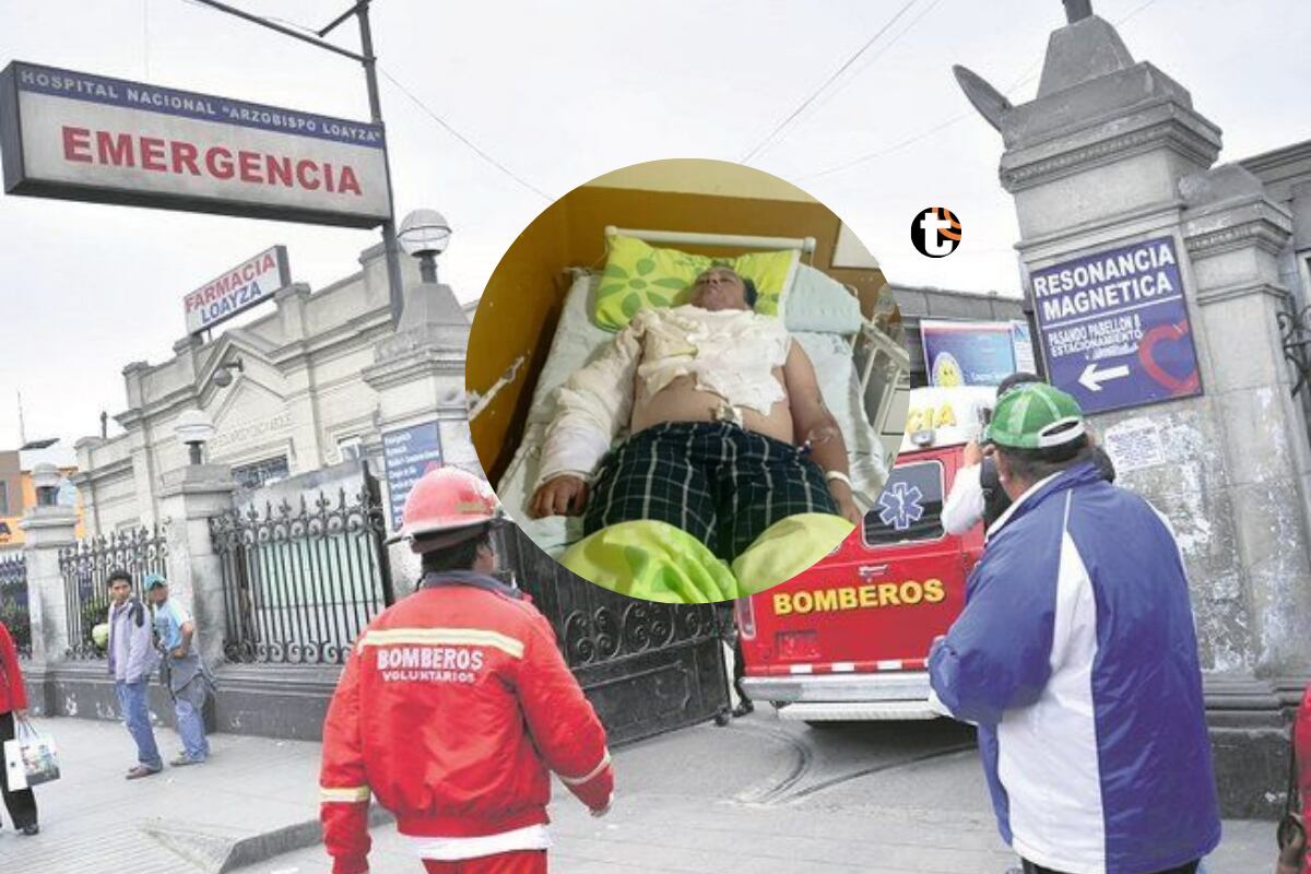 Joven fue rociado con alcohol y quemado por su amigo de infancia