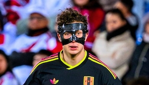 Fabio Gruber se lesionó en la Bundesliga y no estará en los amistosos de la blanquirroja