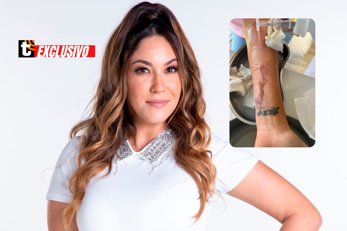 Tilsa Lozano sigue en tratamiento luego de sufrir accidente cuando participaba en 'El gran chef famosos' (Foto: Trome).