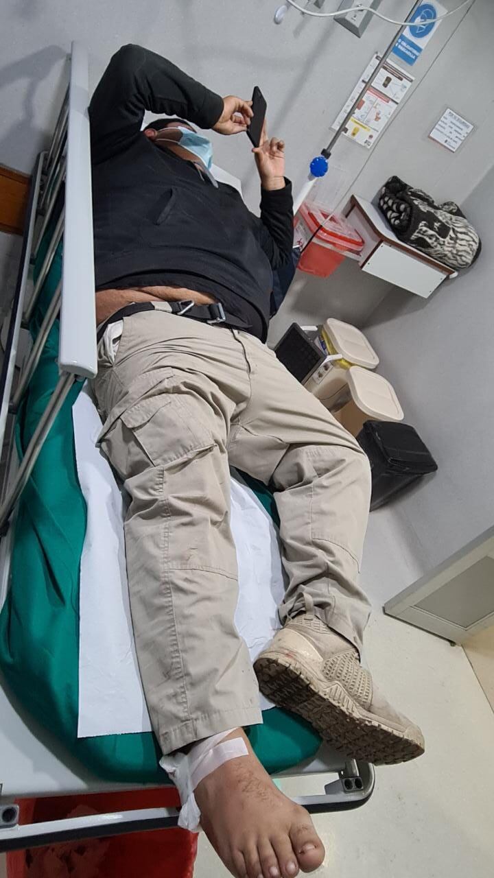 Guardaespaldas herido.