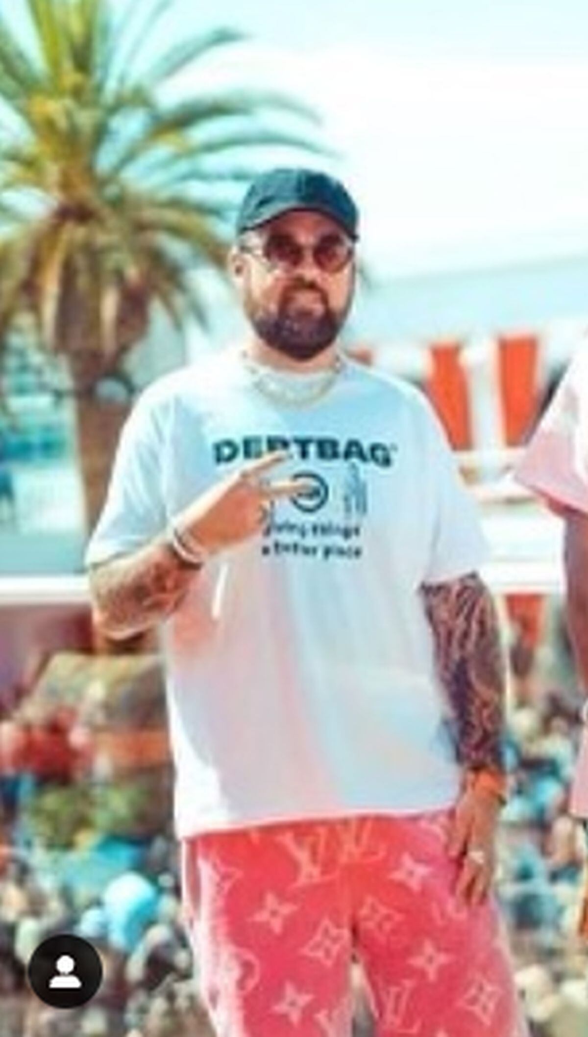 El estadounidense luciendo orgulloso su nuevo físico en sus redes sociales. Aquí tomando sol con unos lentes oscuros (Foto: Chumlee / Instagram)