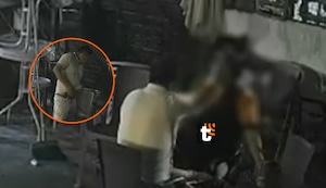 ¡Terror en Tarapoto! Hombre dispara a su esposa en la cabeza y la deja grave en UCI