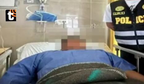 ¡Le llegó el karma! Extorsionador de 17 años pierde la mano tras intentar detonar explosivo en una bodega