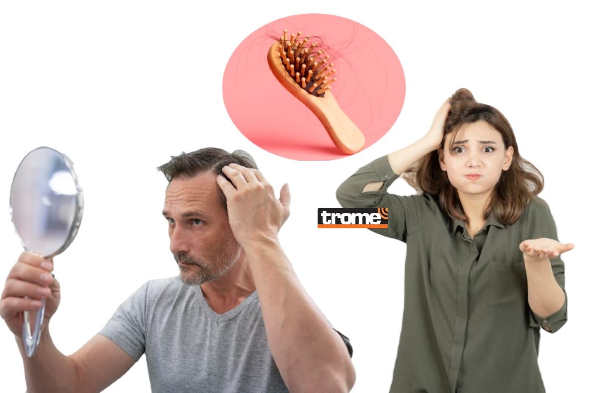 Varios factores podrían afectar la salud capilar. Hay productos que ayudan a cuidarlo. (Isabel Medina / Trome / Balashmirzabey).