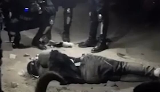 Menor pierde el brazo tras detonar explosivo en paradero de mototaxis