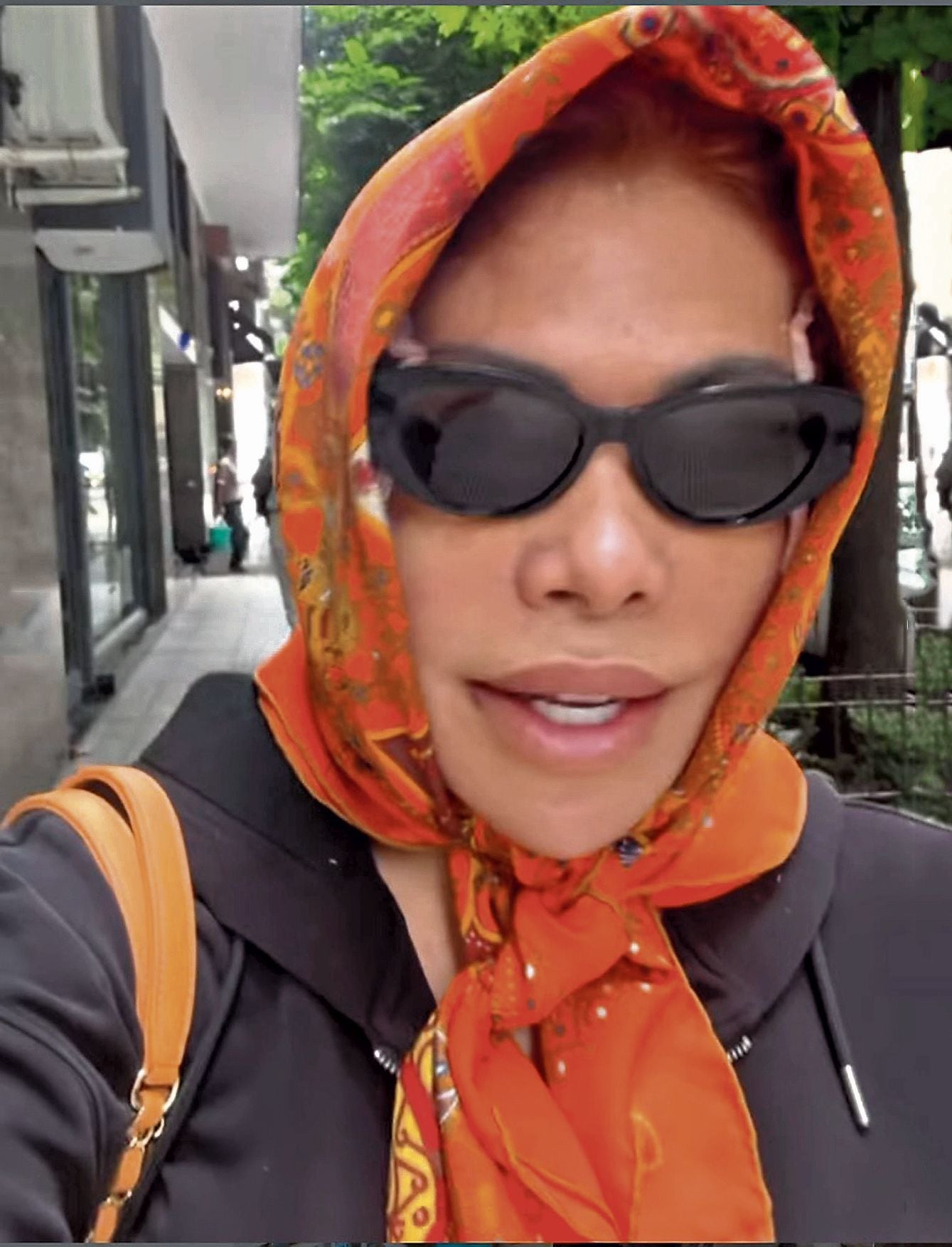 Trolean a Magaly Medina por cirugía en la cara