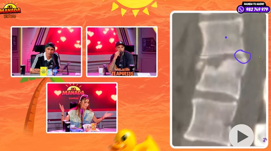 Laura Spoya habla de su vértebra rota