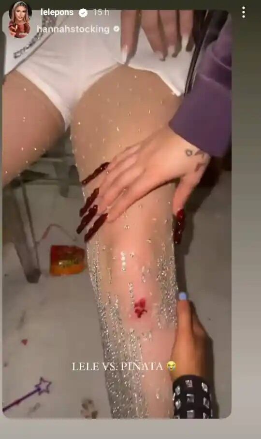 Lele Pons lastimándose el rostro y una rodilla en su despedida de soltera (Foto: Lele Pons/ Instagram)