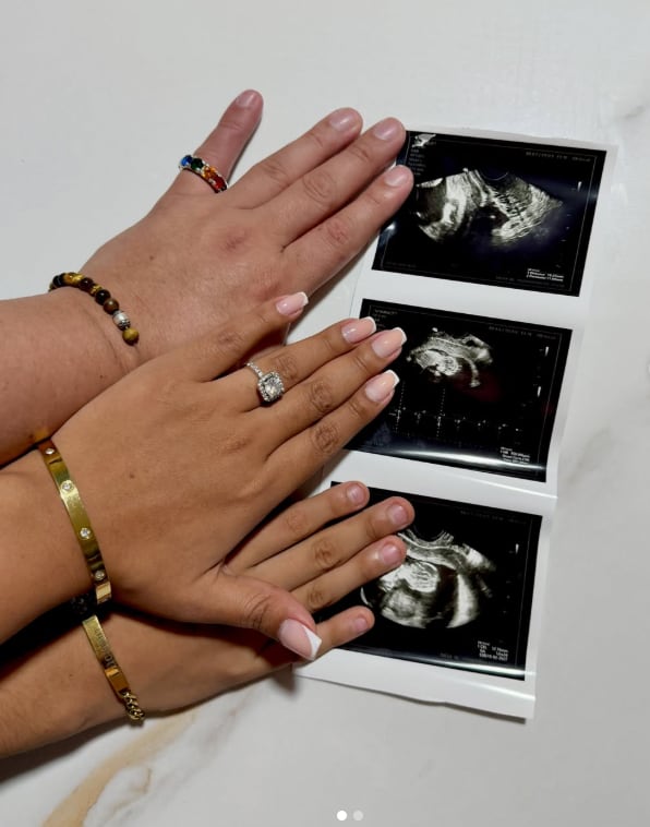 Olenka Mejía anuncia que está embarazada.