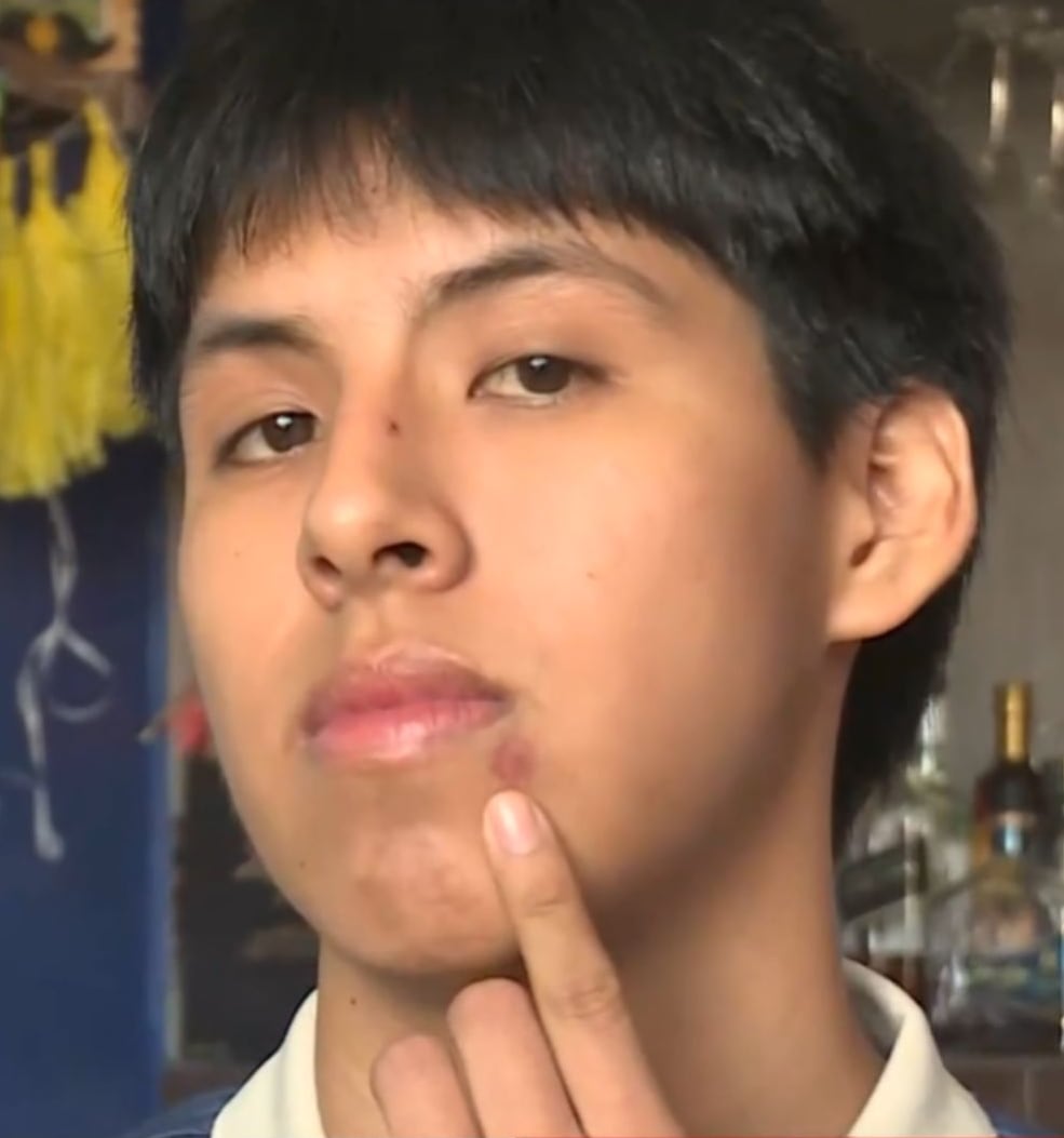 Joven denuncia agresión de Cristorata
