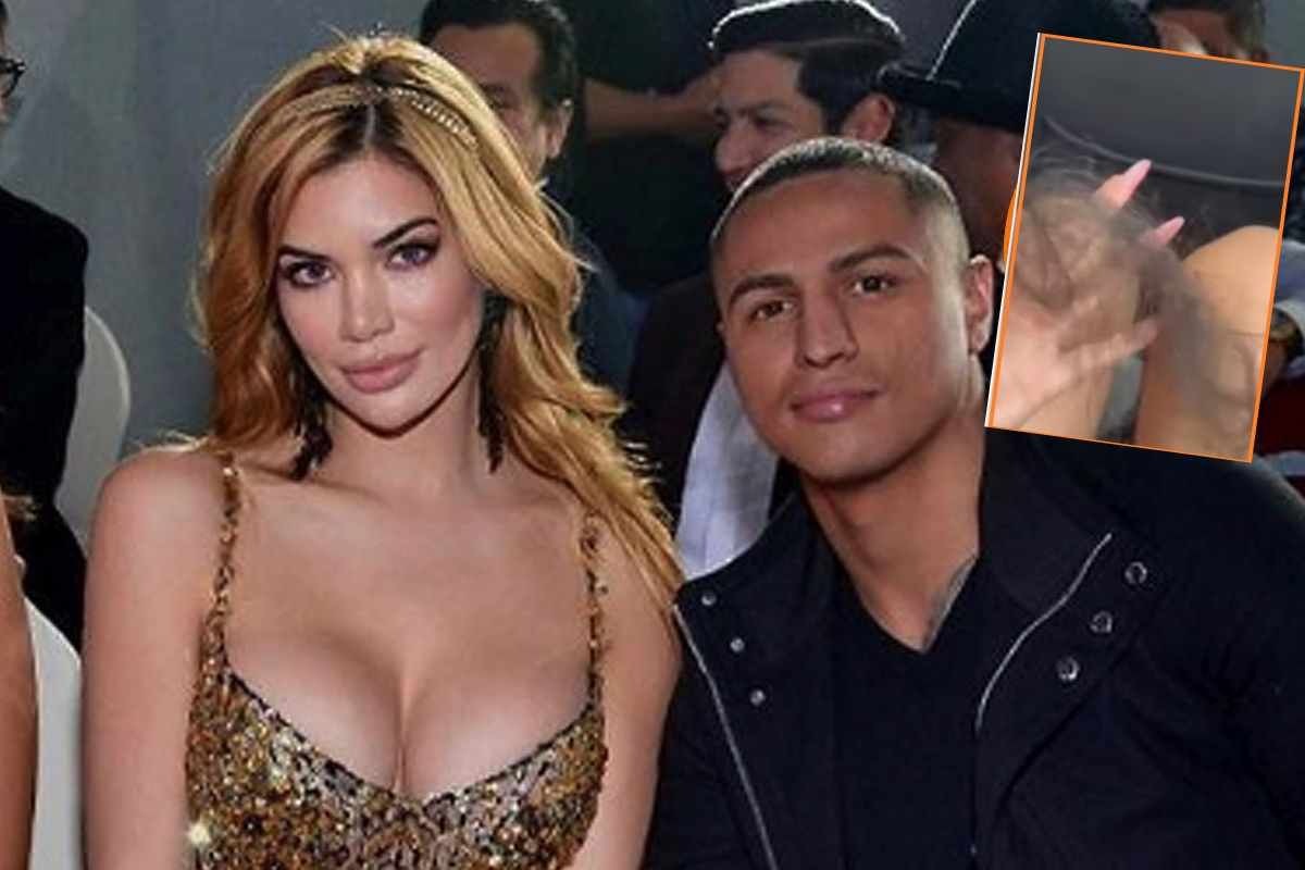 Samantha Batallanos mostró el mechón de cabellos que le arrancho Maicelo.