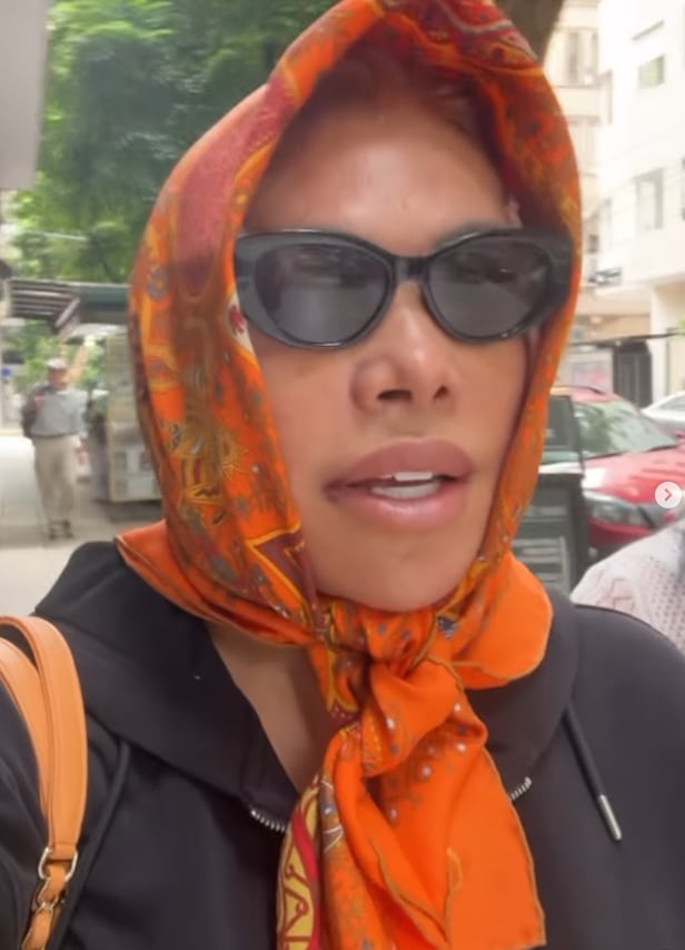 Conductora muestra sus cambios luego de la cirugía estética que se realizó. (Instagram)