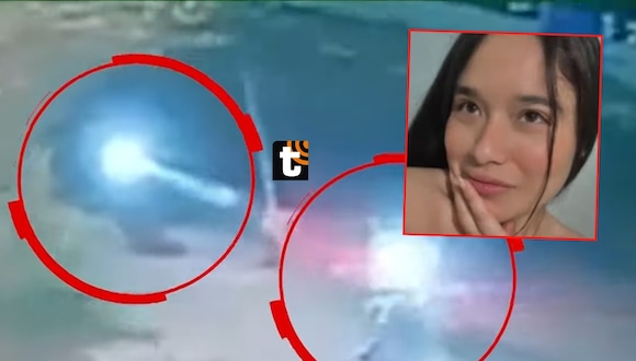 TROME - Joven sufre quemaduras tras atentado