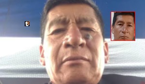 ¡Cayó! Hombre acusado de abuso sexual se operó el rostro, pero fue detenido en Huancayo