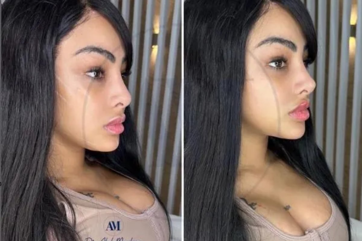 Yailin La Más Viral se realizó una armonización facial, con la cual mejoró el aspecto de su nariz (Foto: Yailin La Más Viral / Instagram)