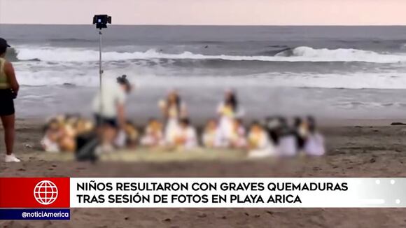 Menor sufre graves quemaduras durante sesión de fotos
