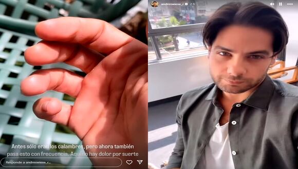 Andrés Wiese contó sobre su rara enfermedad que afecta en las manos