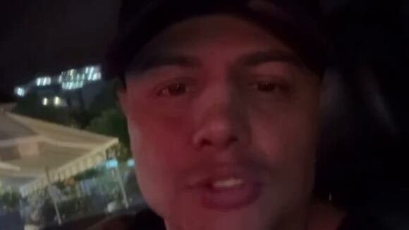 TROME - Jonathan Maicelo le responde a quienes critican su rinoplastia