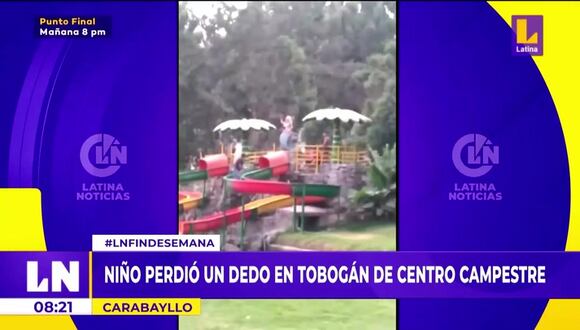 Menor perdió un dedo cuando se deslizaba en tobogán de centro campestre en Carabayllo