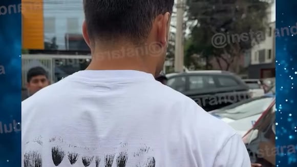 TROME - Said Palao involucrado en accidente vehicular: Su auto y una moto impactaron en Surco