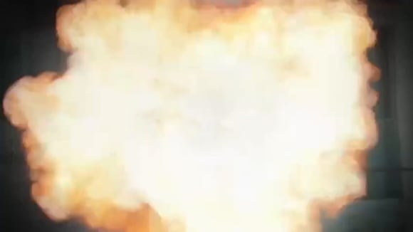 TROME | Ampay en EEG y la palabra en Leslie Shaw