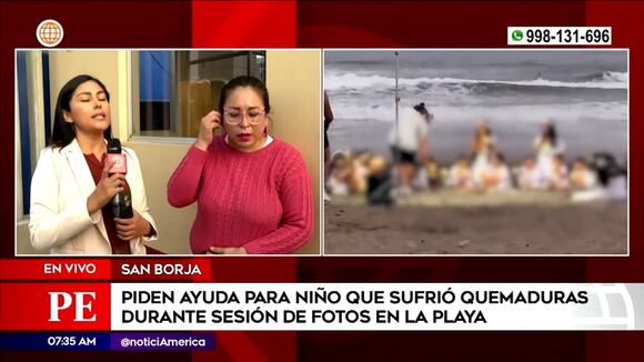 Menor sufre quemaduras durante sesión de fotos en la playa