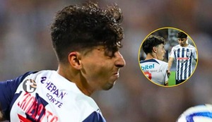 Franco Zanelatto: Así quedó su rostro tras salvaje tacle de ‘La Hiena’ Gómez