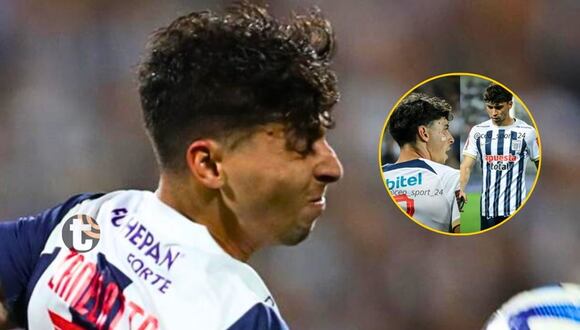 Así quedó rostro de Franco Zanelatto tras patada de Alexi Gómez | VIDEO