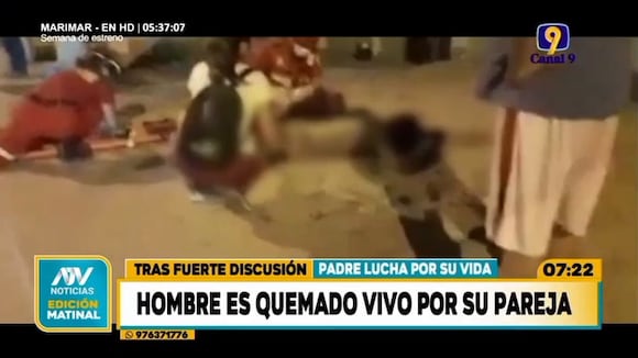 TROME | Hombre es quemado vivo por su pareja