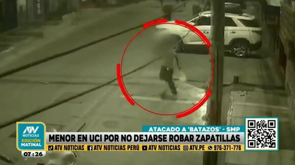 TROME - Entre la vida y la muerte: joven en UCI tras paliza recibida por delincuentes