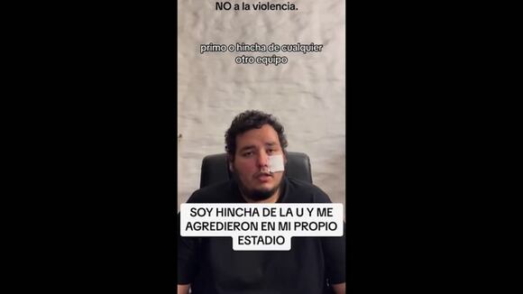 Hincha de Universitario fue desfigurado en la final de Liga Femenina