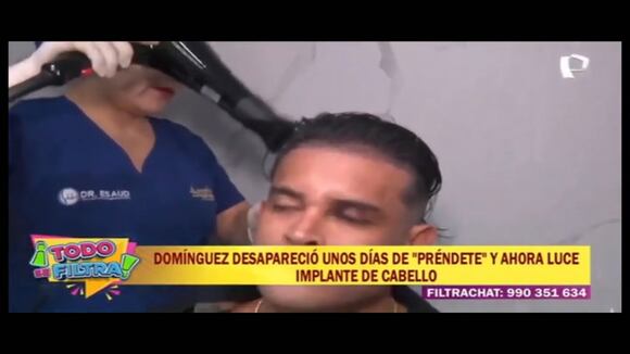 TROME - Domínguez vuelve a la TV con el ojo morado y responde si Karla Tarazona tiene la culpa: ¿Qué dijo?