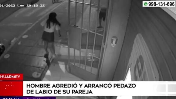 Huarmey: Hombre agredió y arrancó pedazo del labio a su pareja