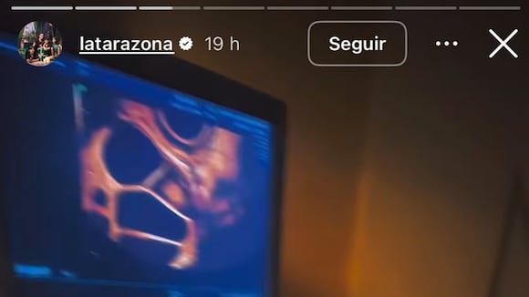 TROME - ¿Busca embarazo? Karla Tarazona comparte video en centro de fertilidad