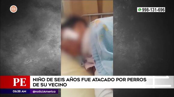 Chilca: Niño de seis años fue atacado por perros de su vecino