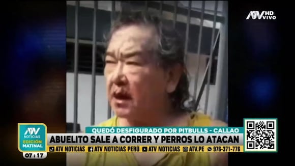 TROME - Callao: adulto mayor es atacado salvajemente por dos pitbulls tras salir a correr