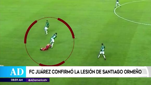 Confirman lesión de Santiago Ormeño (AméricaTV)