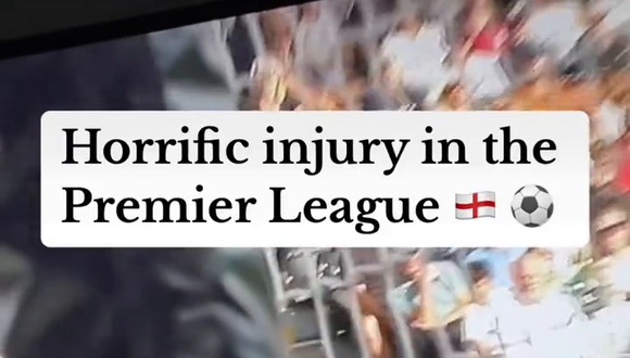Lesión Espeluznante en Premier League