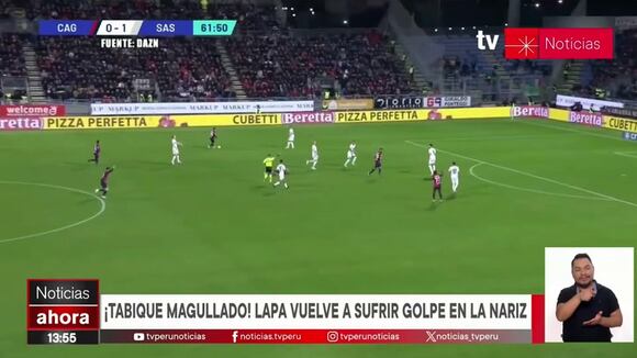 Gianluca Lapadula con el tabique roto por sétima vez