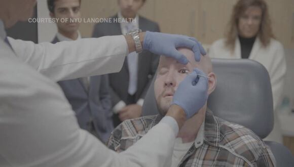Estados Unidos: cirujanos realizan el primer trasplante de ojo completo del mundoo