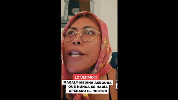 TROME - Magaly habla sobre su cirugía