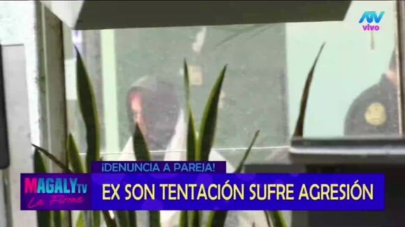 TROME - Ex ‘Son Tentación’ denuncia brutal agresión de su pareja y no da declaraciones