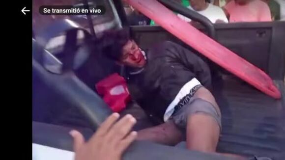 Ucayali: El presunto delincuente Jorge Raúl Monja Gonzales (20) recibió una brutal paliza por vecinos y transeúntes, siendo rescatado por la policía. (Cortesía Ceymo Rengifo)