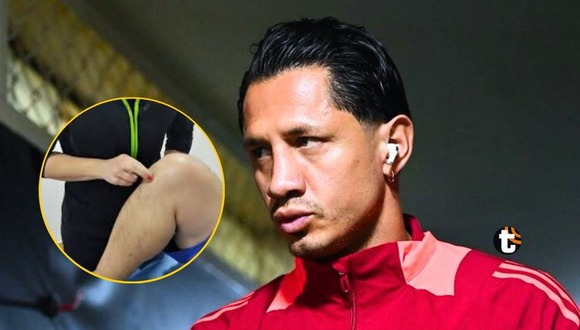Gianluca Lapadula sufriría lesión en la rótula que ha requerido que especialista peruano viaje a Italia para su tratamiento (Video: RPP)