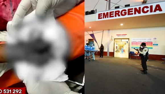 Ate: Niño de 8 años perdió parte de su mano tras manipular pirotécnico