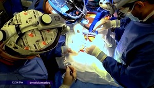Murió receptor del primer trasplante de riñón de cerdo en Estados Unidos